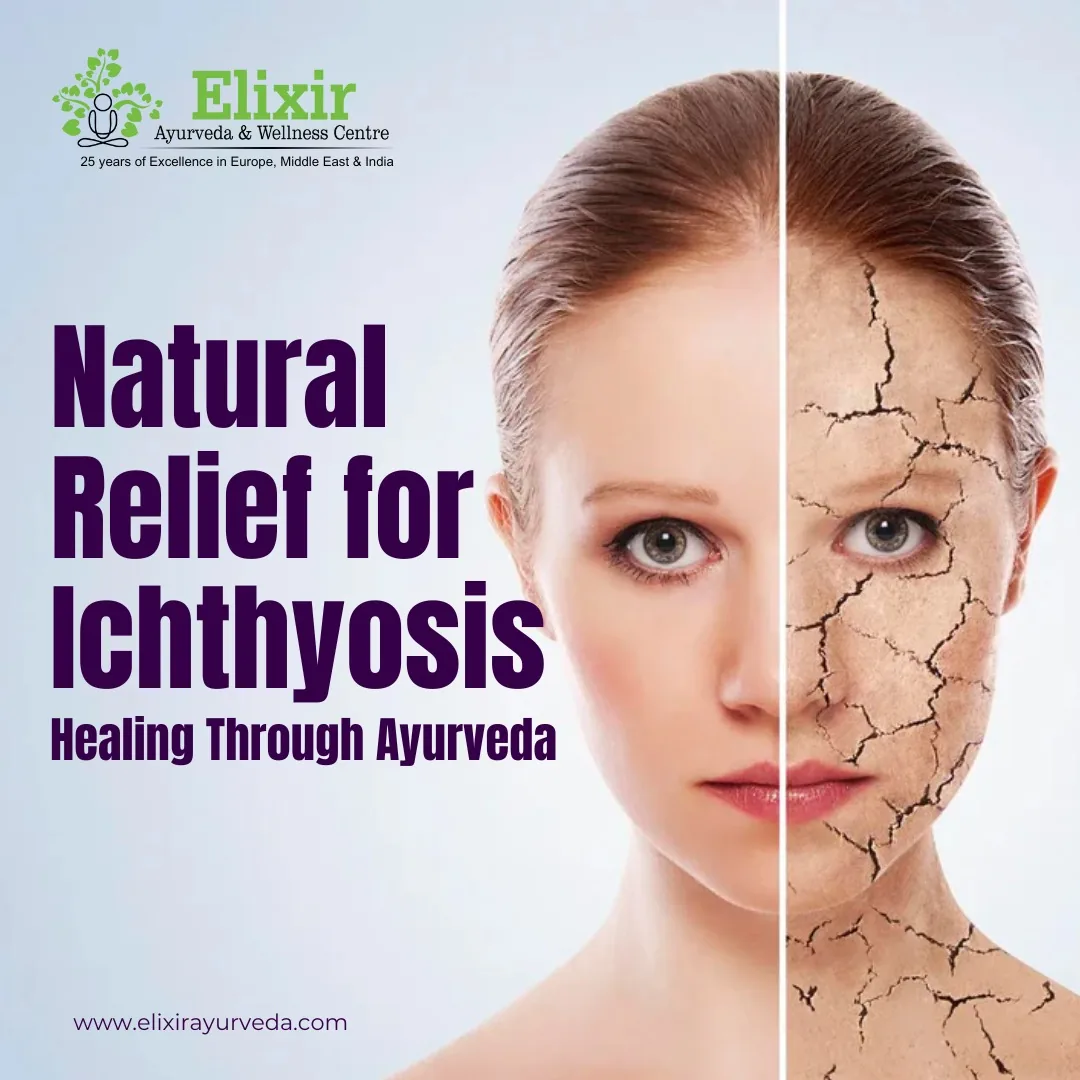 Natural Relief for Ichthyosis Healing Through Ayurveda