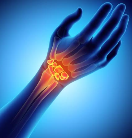 Empower Your Hands: Discover Ayurvedic Treatment for Carpal Tunnel Syndrome